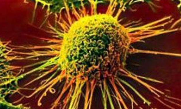 Death rates far higher for 'alternative' cancer cures- AFP