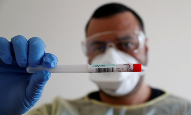A member of the medical staff shows a used sample container at a test centre for coronavirus disease (COVID-19) at Havelhoehe community hospital in Berlin, 2020. REUTERS/Fabrizio Bensch -/File Photo