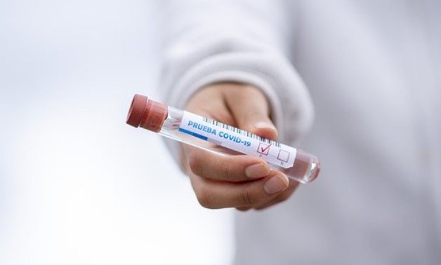 FILE – A test tube showing positive coronavirus result – Fernando Zhiminaicela/Pixabay