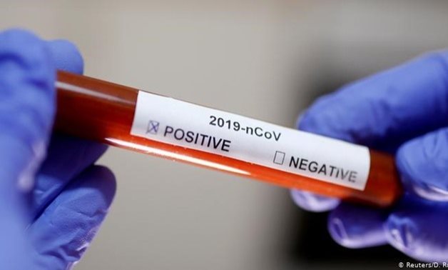 FILE - Coronavirus test result - Reuters