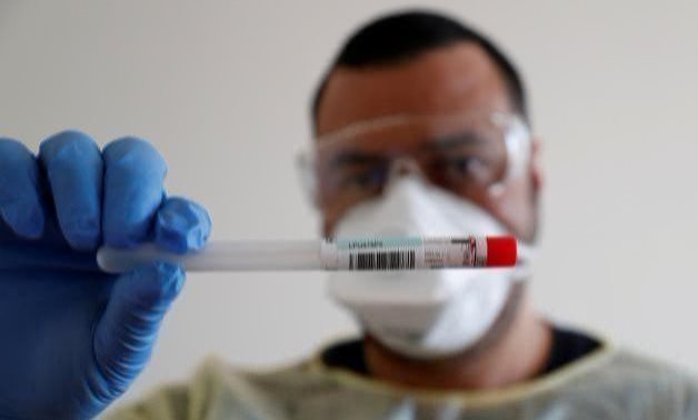 FILE: A member of the medical staff shows a used sample container at a test center for coronavirus disease (COVID-19) in Berlin, Germany, April 6, 2020. - Reuters