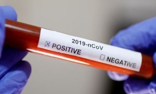 FILE - A coronavirus test tube - Reuters