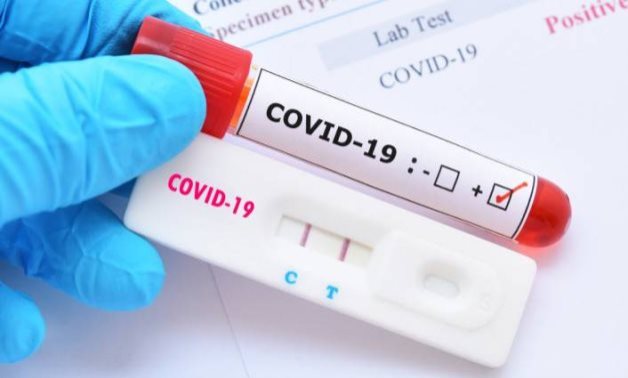 FILE – Coronavirus test – CC