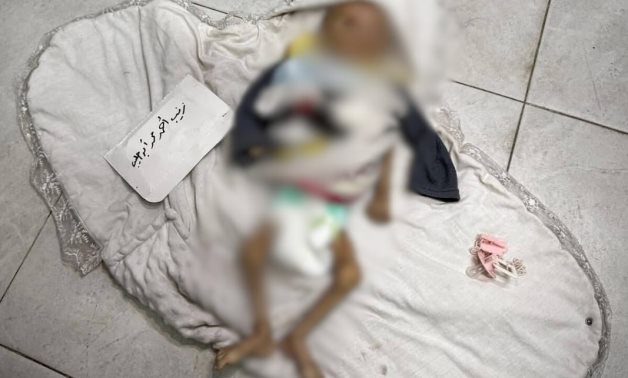 Zeinab, an infant died of malnutrition in Gaza due to the Israeli starvation war on the enclave- press photo from the Palestinian Ministry of Health in Gaza on July 27, 2025