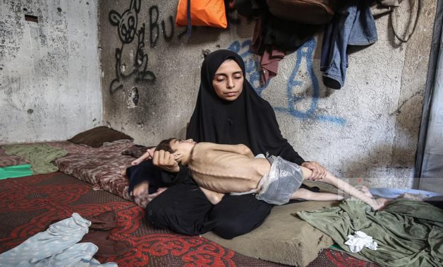 According to Gaza’s health ministry, at least 281 people have died from starvation and malnutrition as of Saturday, 23 August, 2025, 114 of them children. File photo by WAFA from Gaza