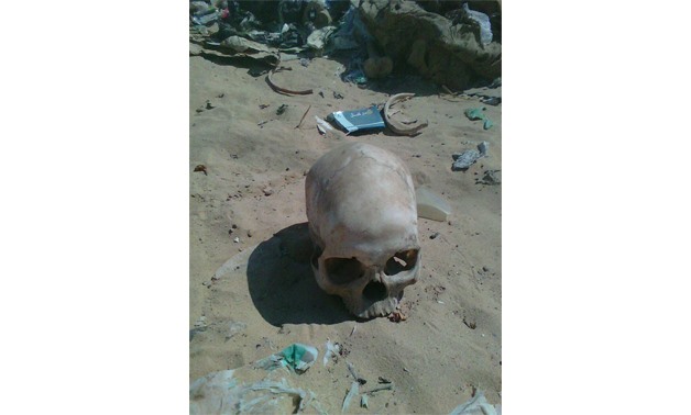One of the skulls dumped in a landfill at Asyut governorate in Upper Egypt
