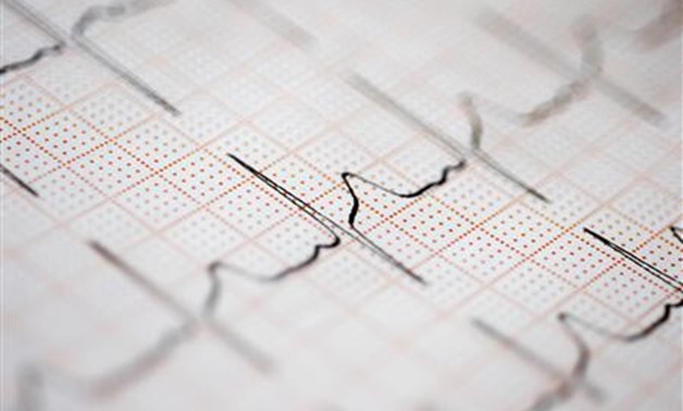 A close-up of an ECG report is seen in this undated handout photo - REUTERS/Newscom