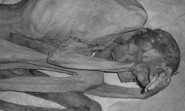 An infrared image of the female mummy known as 'Gebelein Woman' can be seen in this photograph issued by The British Museum in London, Brita