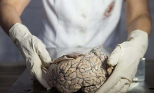 © AFP/File | A human brain on display at the "Museum of Neuropathology" in Lima, Peru
