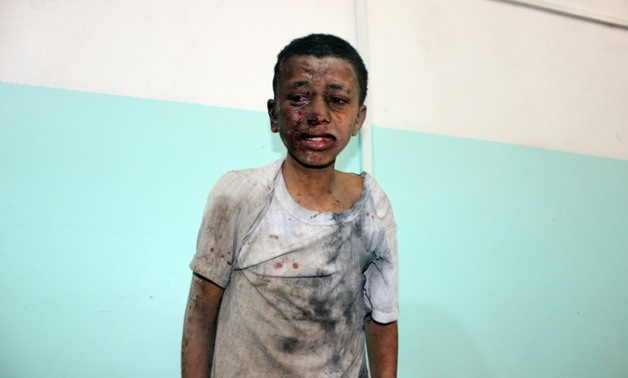 A Yemeni child awaits treatment at a hospital after he was wounded in a reported air strike on the rebel stronghold of Saada on August 9, 2018

