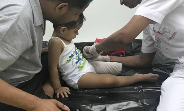The youngest witness of Houthi’s crimes in Taez able to walk again