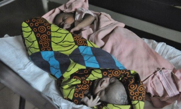 While rates of under-five deaths in the sub-Saharan African region have declined over two decades, the improvement has been much slower for twins than for single-borns - AFP - File photo