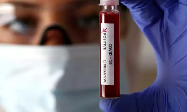FILE – A health worker handling a coronavirus test sample – Reuters