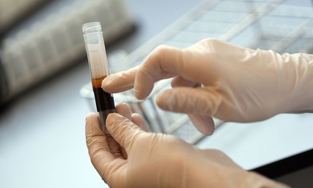 FILE - Sonja Krauthoefer of the University Hospital Erlangen checks donated blood and plasma samples - Reuters