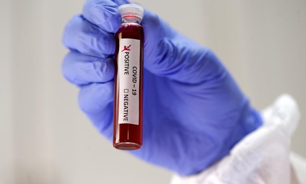 FILE PHOTO: Fake blood is seen in test tubes labelled with the coronavirus (COVID-19) in this illustration taken March 17, 2020. REUTERS/Dado Ruvic/Illustration/File Photo