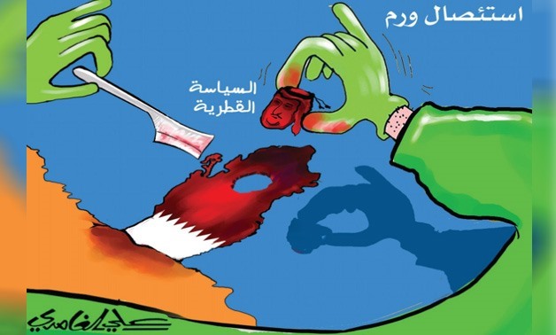 Caricaturist Ali al-Ghamdy drew Tamim Bin Hamad’s head as a tumor being extracted from the Arab region’s body – Courtesy of Al-Madina newspaper