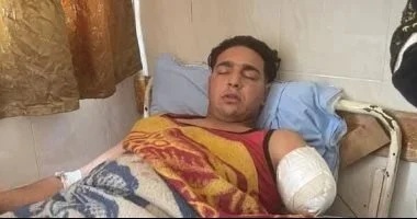 Circus performer had his arm amputated after a white tiger attack Circus performer had his arm amputated after a white tiger attack