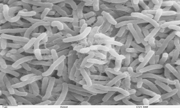 Scanning electron microscope image of Vibrio cholerae CC Wikibedia