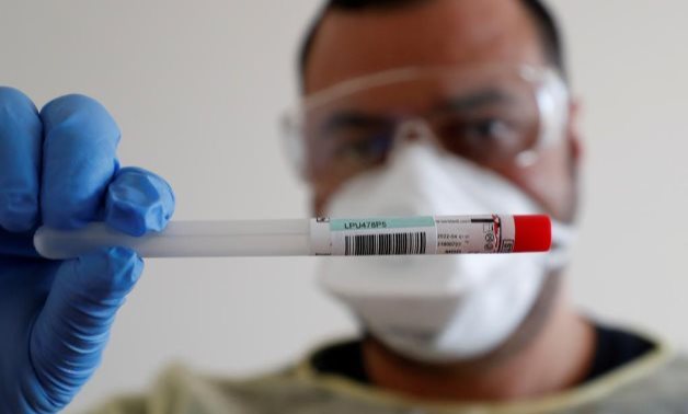 FILE : A member of the medical staff shows a used sample container at a test centre for coronavirus disease at Havelhoehe community hospital in Berlin, Germany, April 6, 2020. Reuters