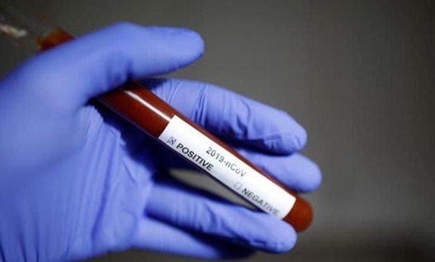 Test tube with Coronavirus name label is seen in this illustration. (File photo: Reuters)