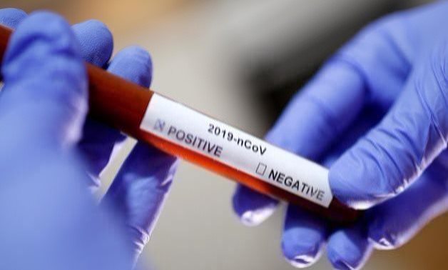 FILE - coronavirus test sample - Reuters