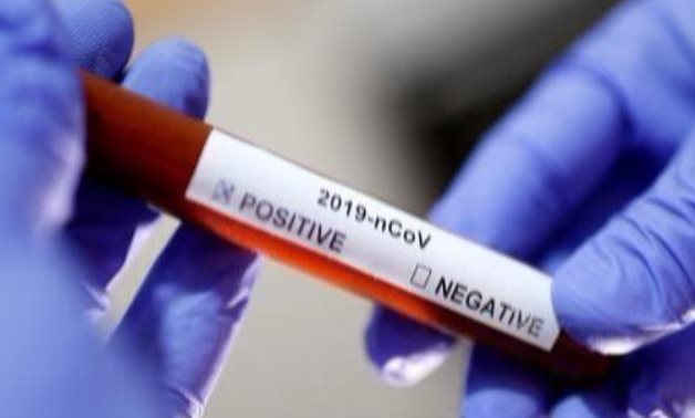 FILE - Blood sample test - Reuters