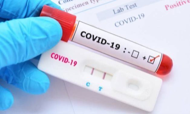 FILE – Coronavirus test – CC