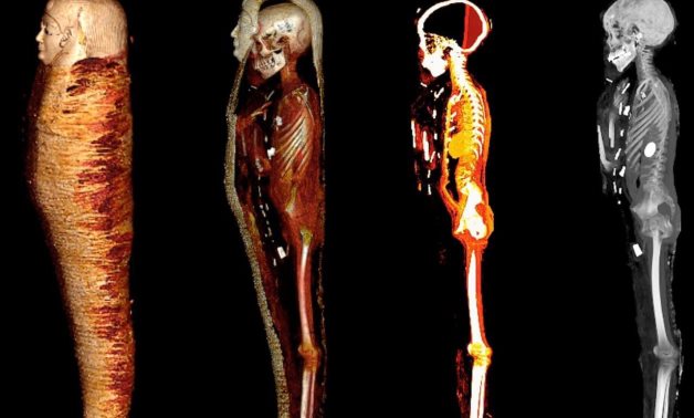 File: CT scanning and 3D printing revealed secrets of the golden boy mummy stored in the Egyptian Museum’s basement.