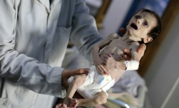 The UN rights chief says the pictures of a Syrian infant suffering from severe malnutrition were a "frightening indication" of the plight of people in Eastern Ghouta