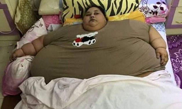 World’s heaviest person loses 120kg- YOUM7 (Archive)