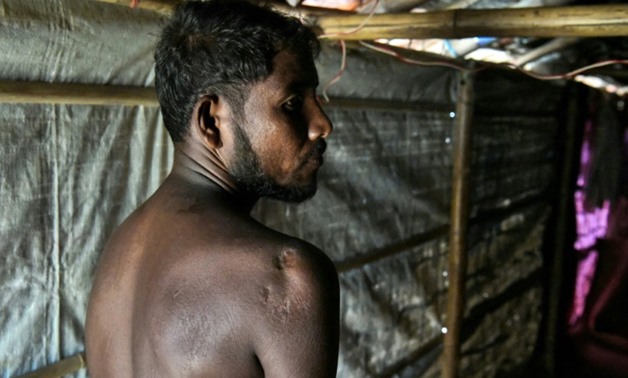 Mohammad Sikander was shot in the shoulder by the military while in his home in Myanmar in September 2017
