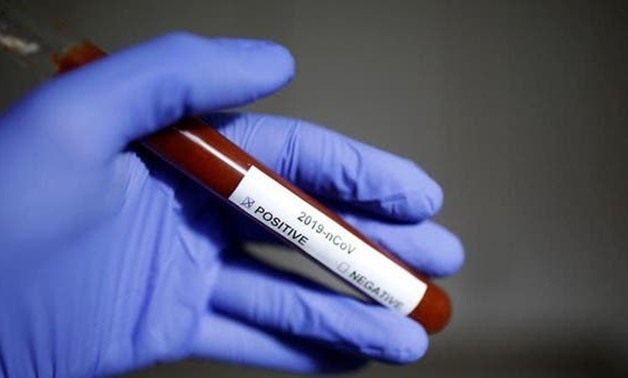 FILE – Coronavirus test sample – Reuters 